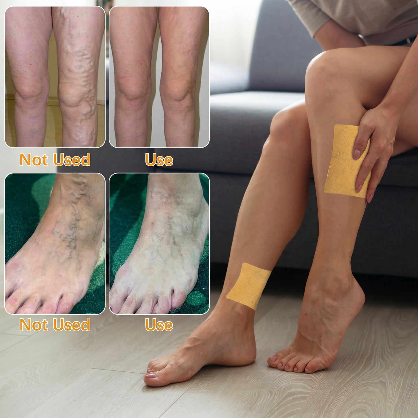 Varicose Veins Relief Patches - Reduces Swelling, Relieves Pain, Improves Blood Circulation & Vein Health