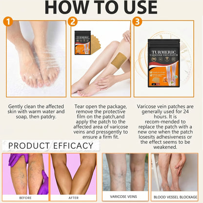 Varicose Veins Relief Patches - Reduces Swelling, Relieves Pain, Improves Blood Circulation & Vein Health