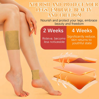 Varicose Veins Relief Patches - Reduces Swelling, Relieves Pain, Improves Blood Circulation & Vein Health
