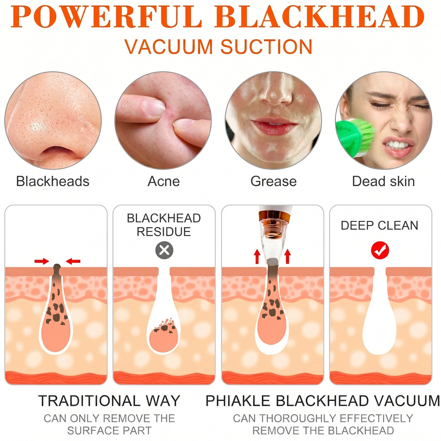 6 in 1 Multi-function Blackhead Remover Tools